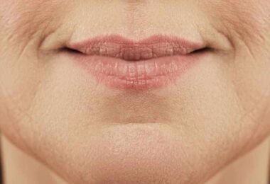 Mujer con arrugas prematuras en su rostro
